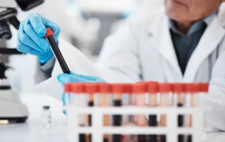 alzheimers-blood-test-photo