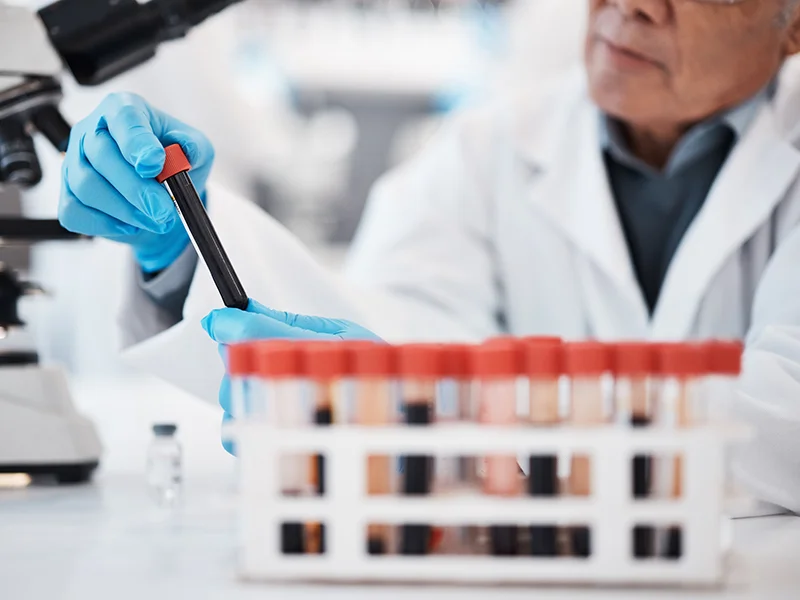 alzheimers-blood-test-photo